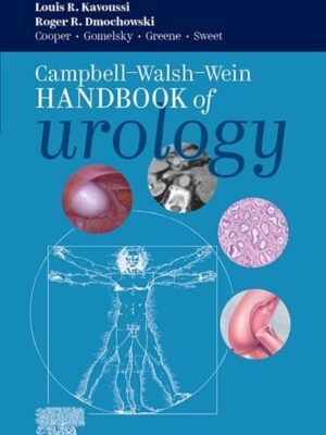 Campbell Walsh Wein Handbook of Urology