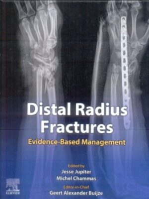 DISTAL RADIUS FRACTURES: EVIDENCE-BASED MANAGEMENT