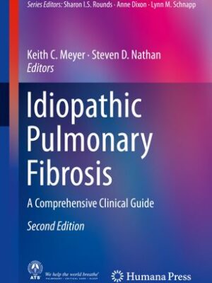 Idiopathic Pulmonary Fibrosis: A Comprehensive Clinical Guide